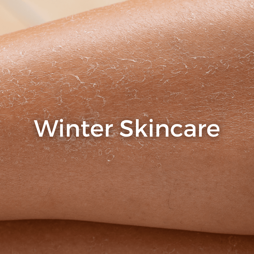 8 Winter Skincare Musts to Avoid Dry, Flaky Skin! - CHEEKYGLO