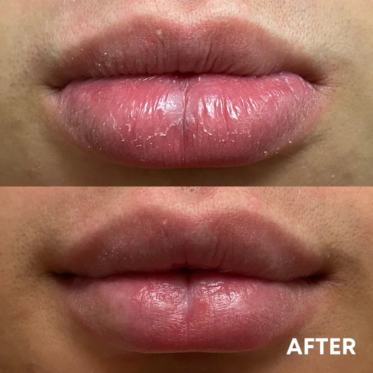 before and after using the cheekyglo silk exfoliating face mitt on dry lips
