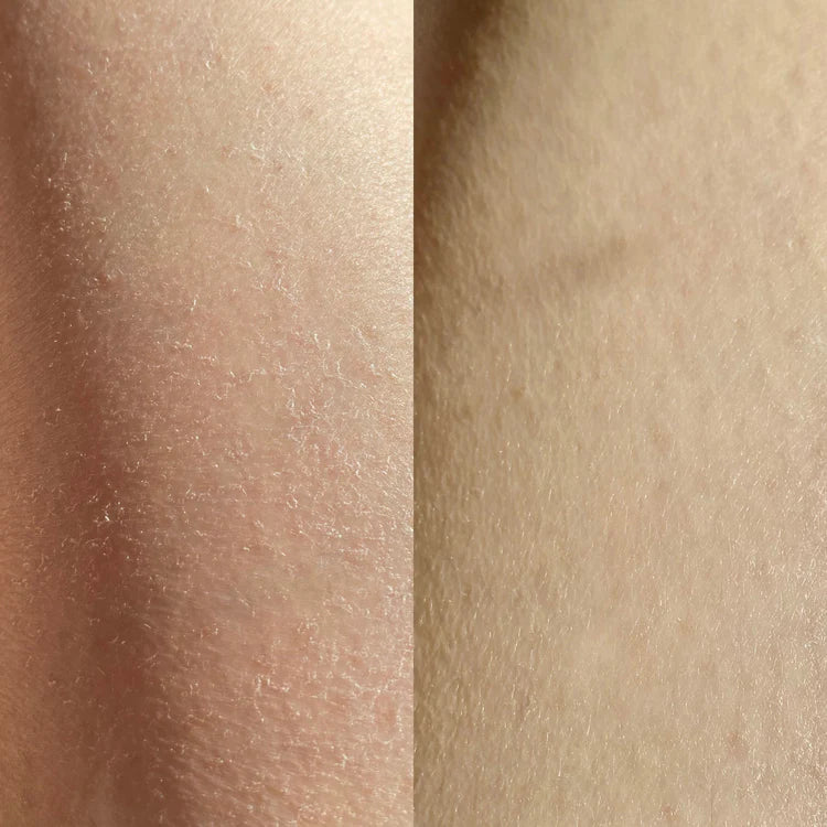before and after using the cheekyglo exfoliating glove on dry skin