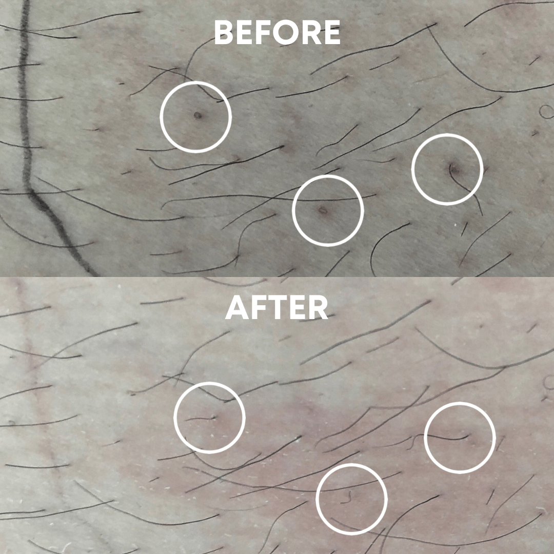 CheekyGlo Exfoliating Glove - CHEEKYGLO