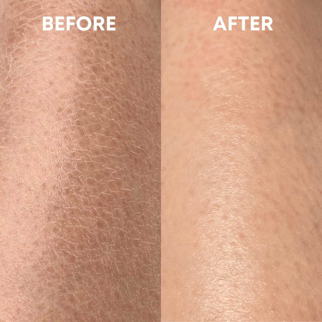 CheekyGlo Exfoliating Loofah Glove - CHEEKYGLO