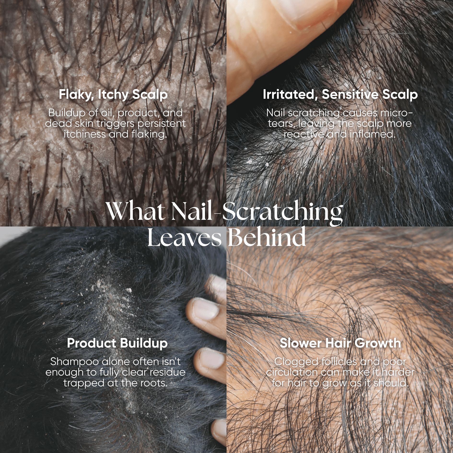 CheekyGlo Scalp Scrubber - CHEEKYGLO