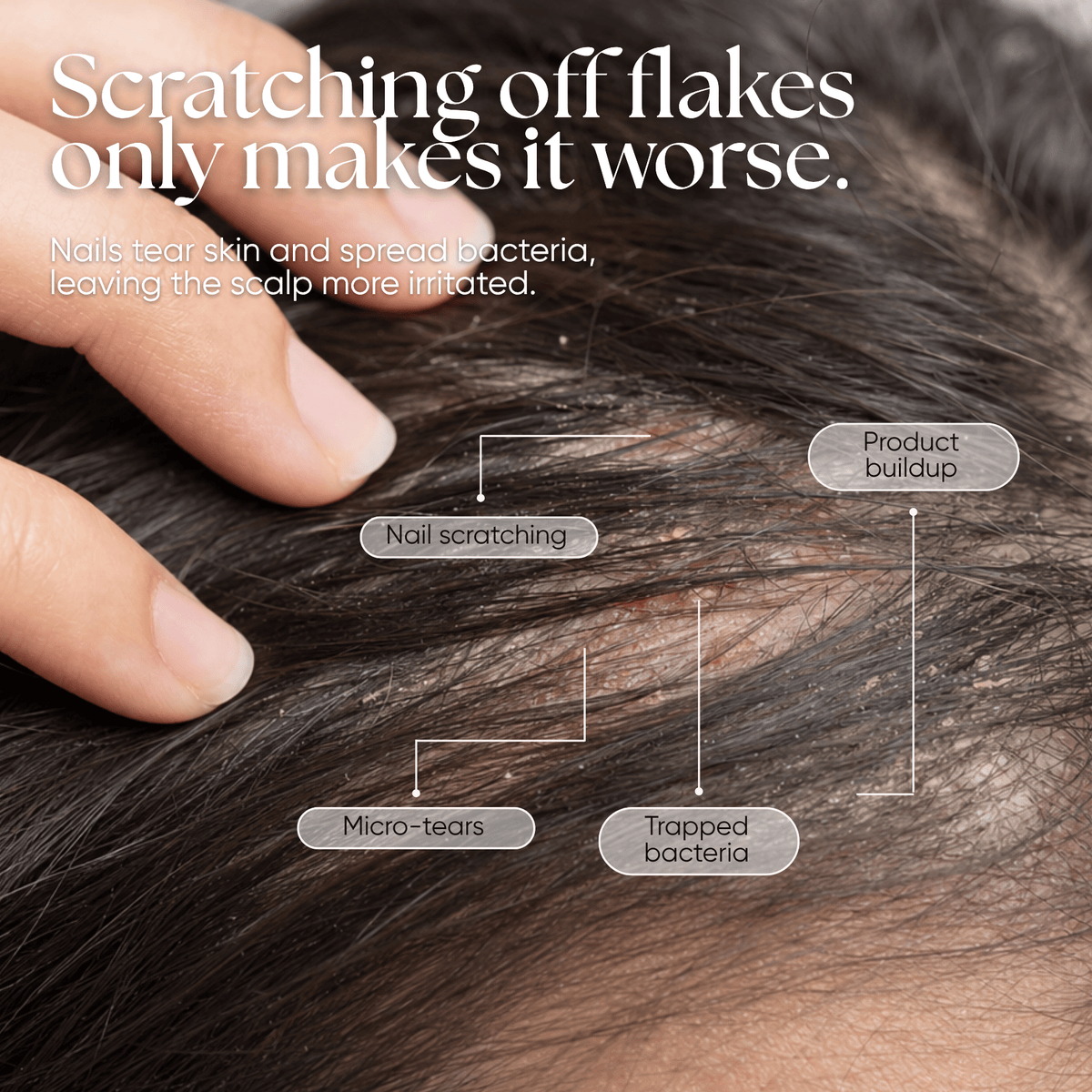 CheekyGlo Scalp Scrubber - CHEEKYGLO