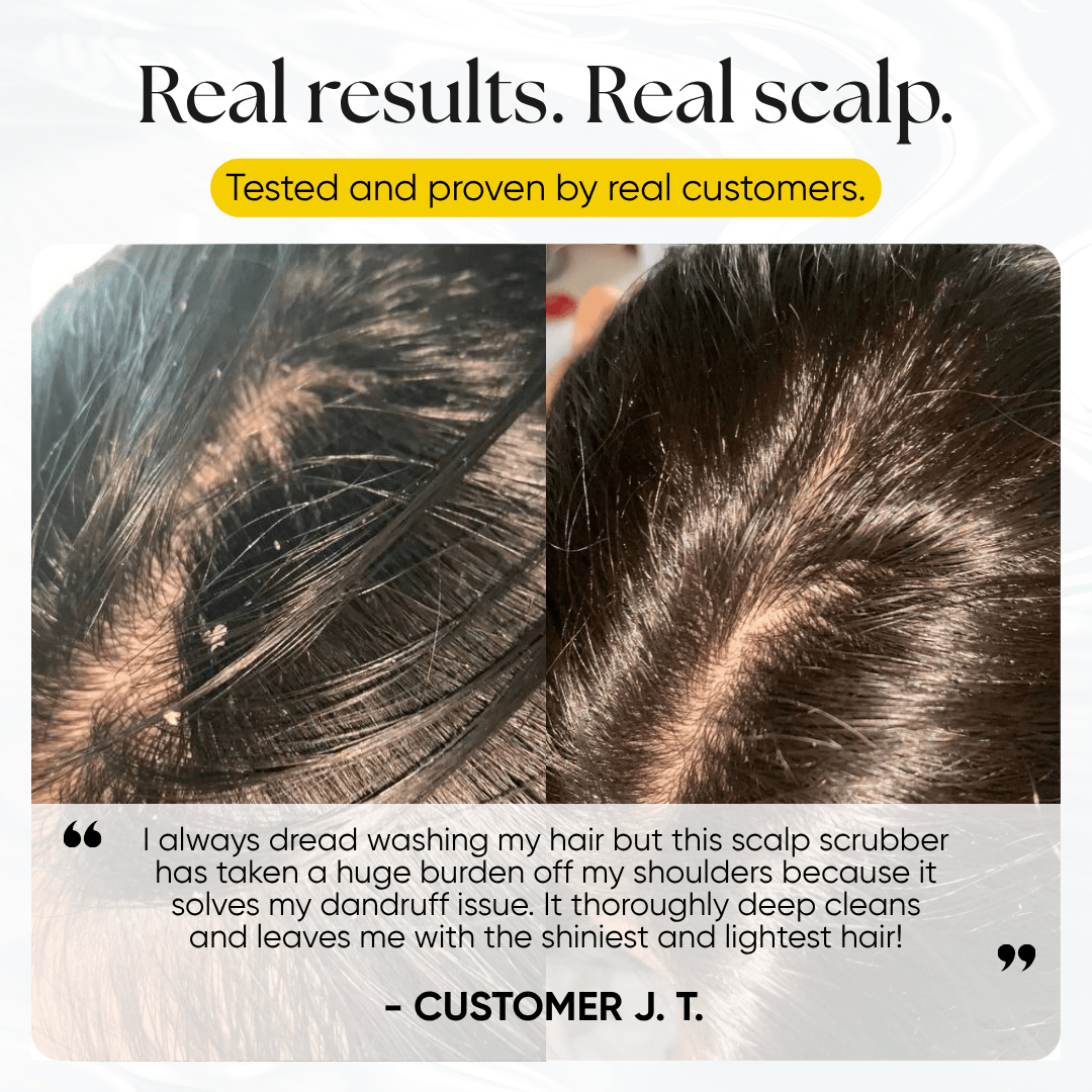 CheekyGlo Scalp Scrubber - CHEEKYGLO