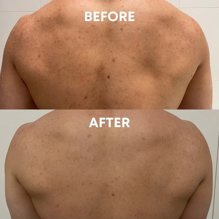 Everyday Essentials Set - CHEEKYGLO