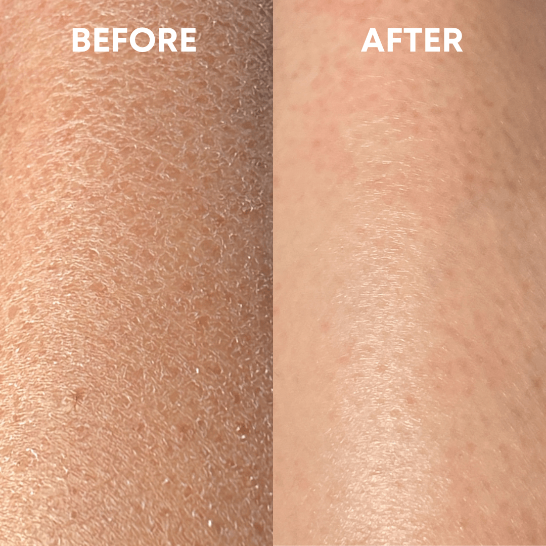 Exfoliating Body Duo - CHEEKYGLO