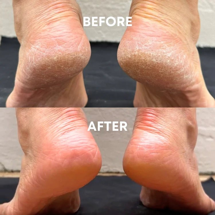 Foot Balm - CHEEKYGLO