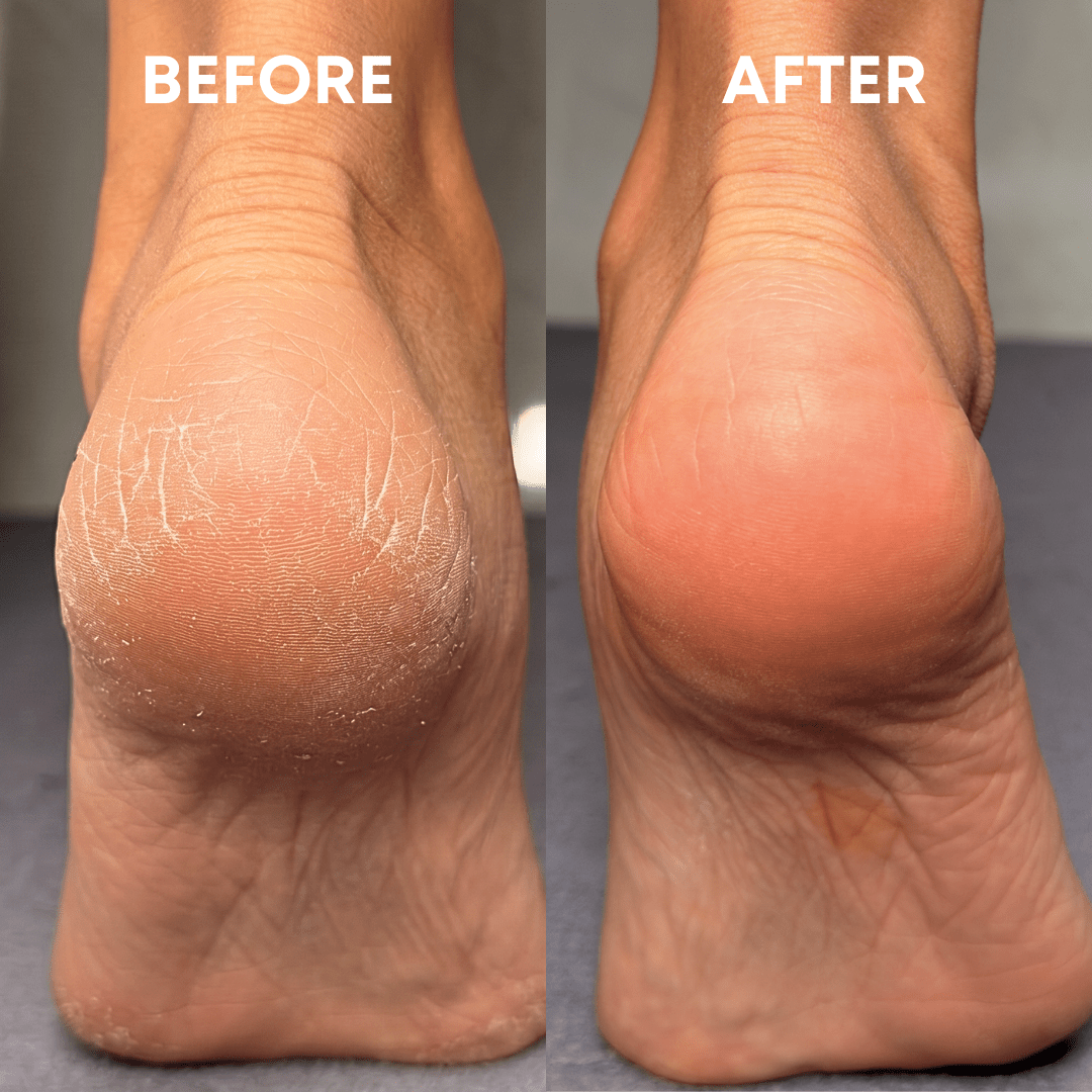 Foot Reset Bundle - CHEEKYGLO