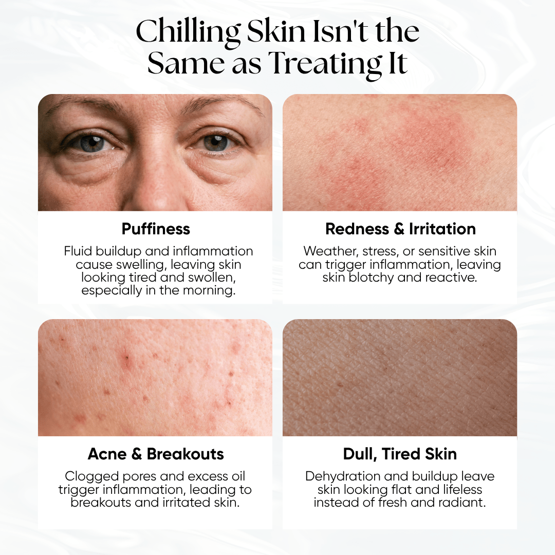 Ice Slushy Soothing Mask - CHEEKYGLO
