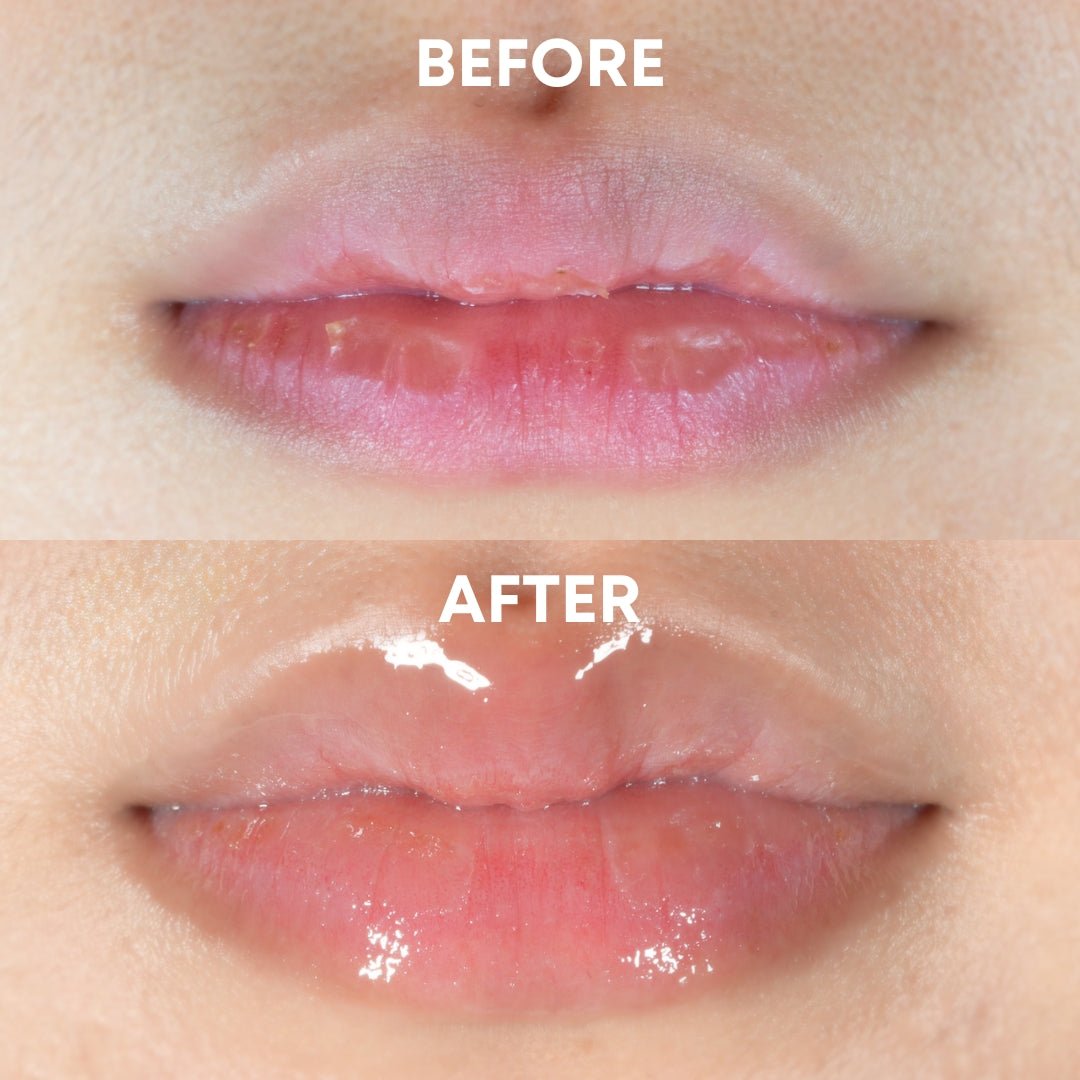 Lip Repair Essence - CHEEKYGLO