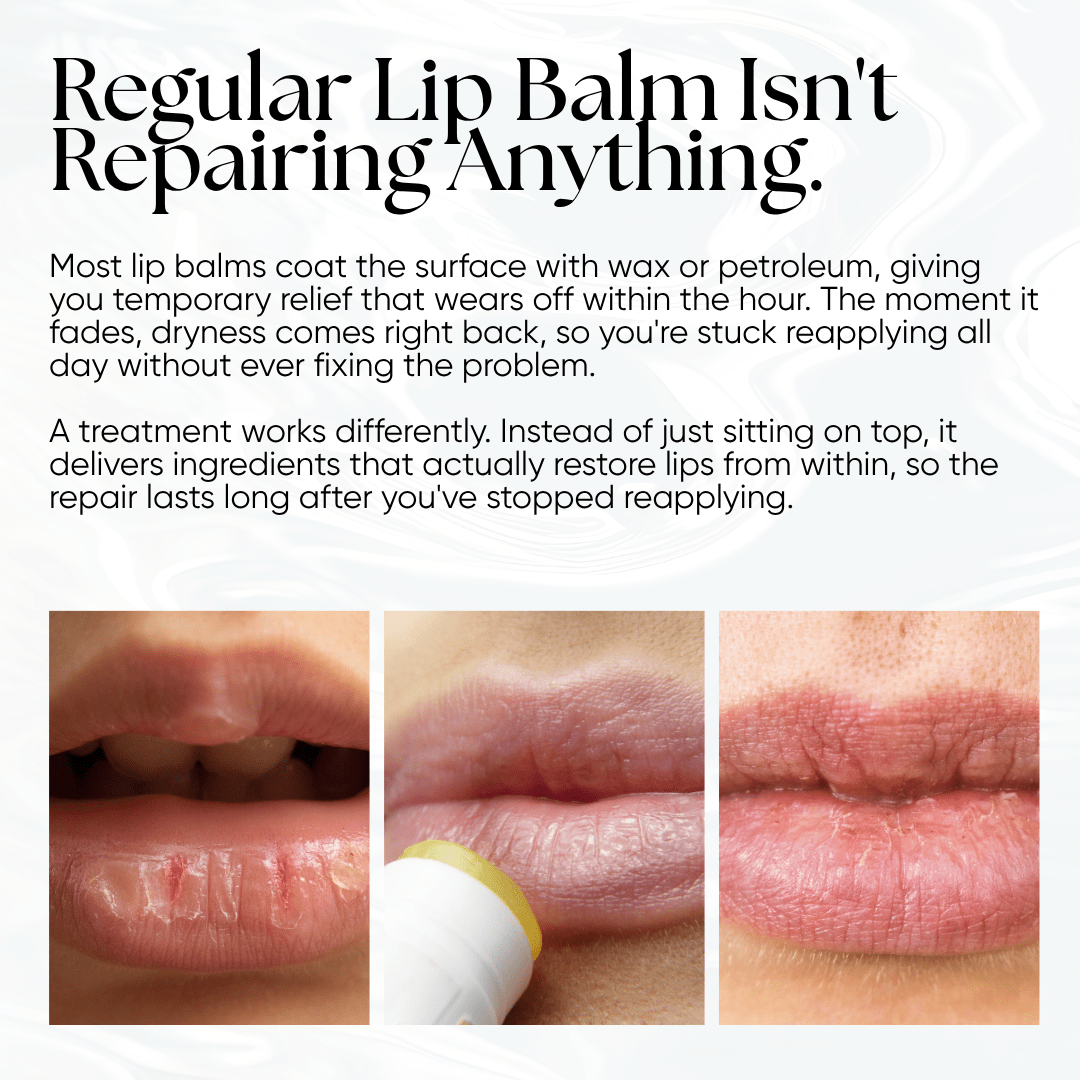 Lip Repair Essence - CHEEKYGLO