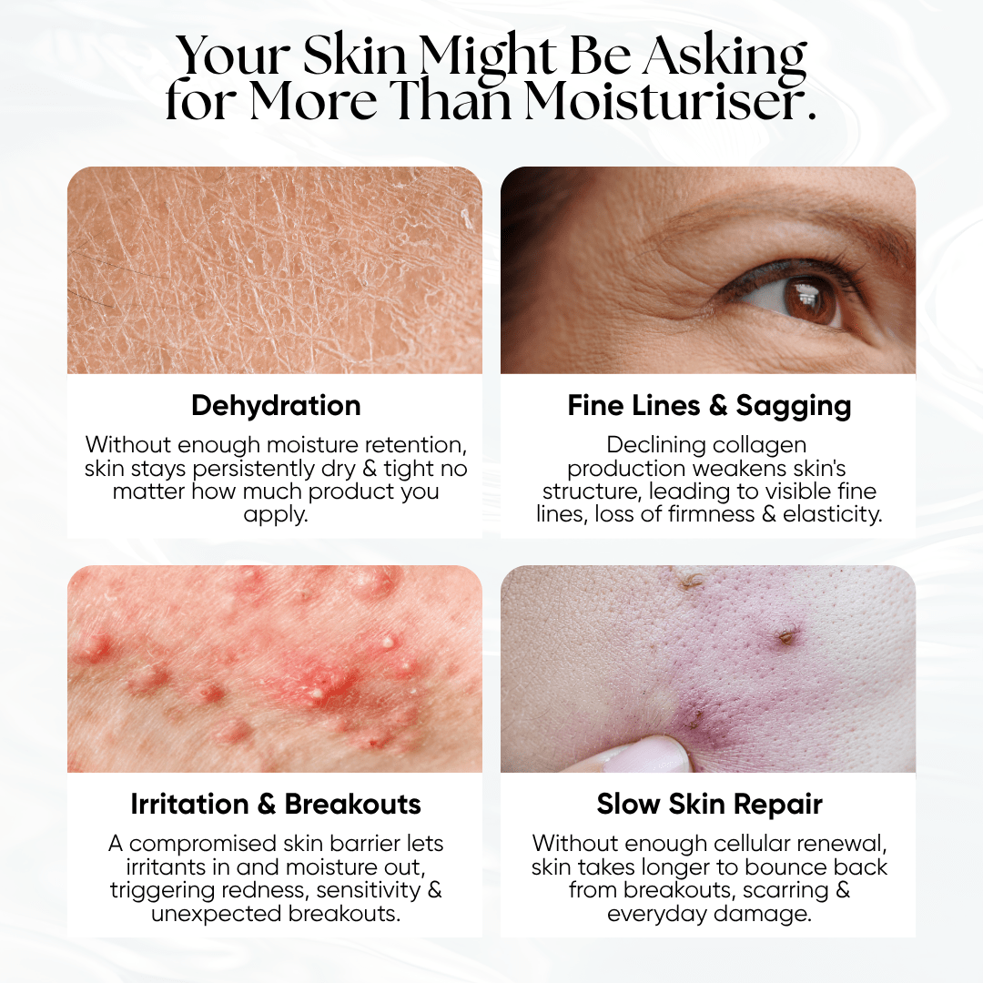 PDRN Plus+ Advanced Collagen Peptide Cream - CHEEKYGLO