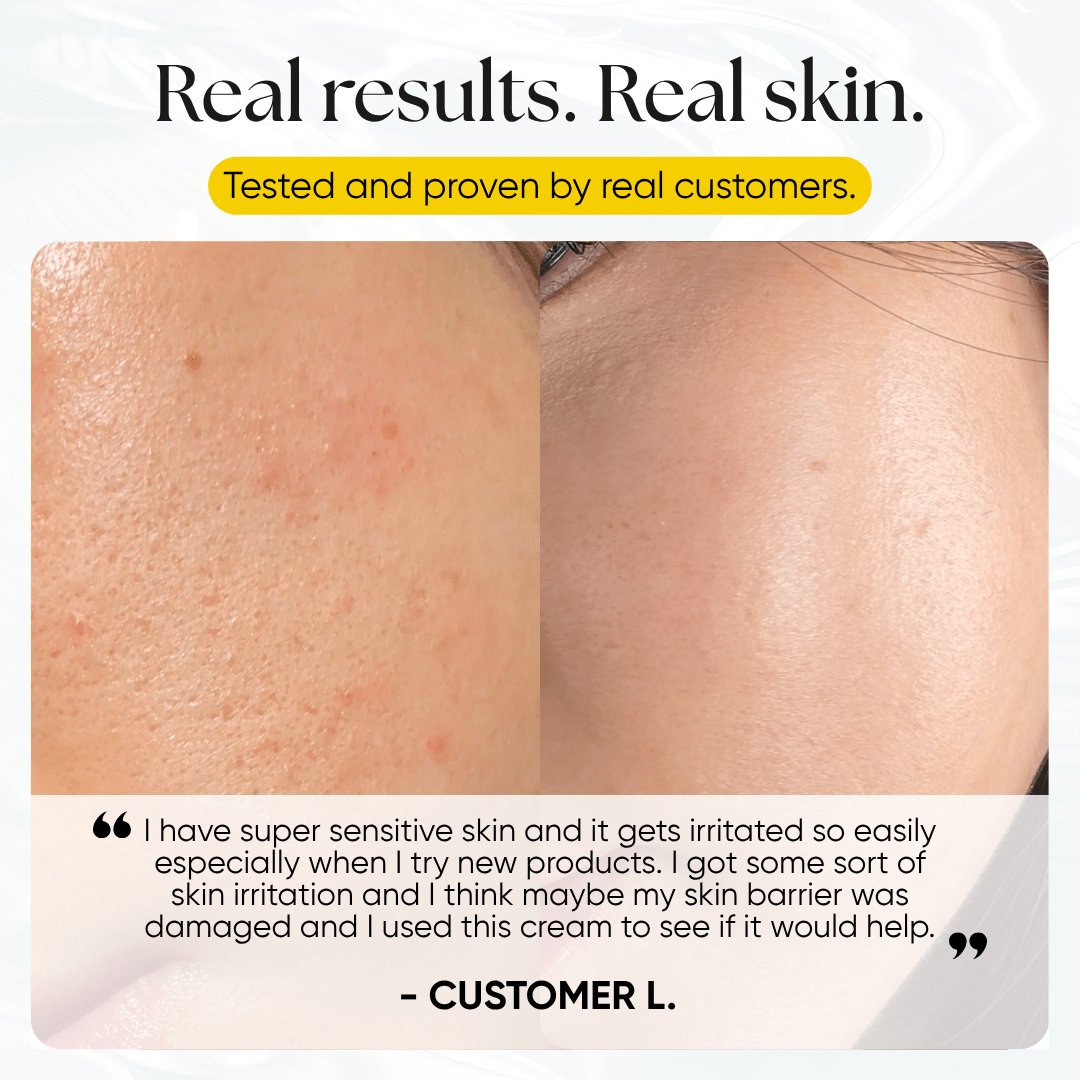 PDRN Plus+ Advanced Collagen Peptide Cream - CHEEKYGLO