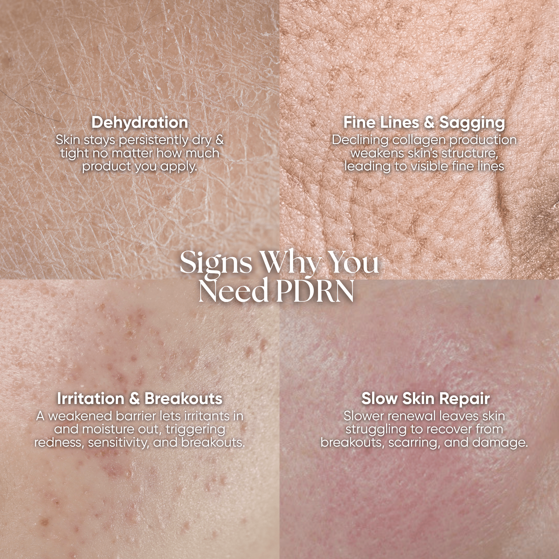 PDRN Plus+ Advanced Collagen Peptide Cream - CHEEKYGLO
