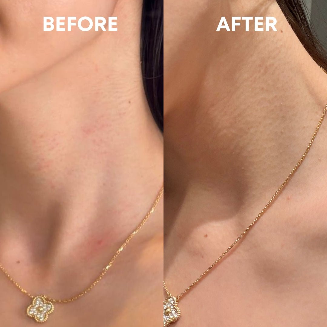 Skin Reset Hypochlorous Spray - CHEEKYGLO