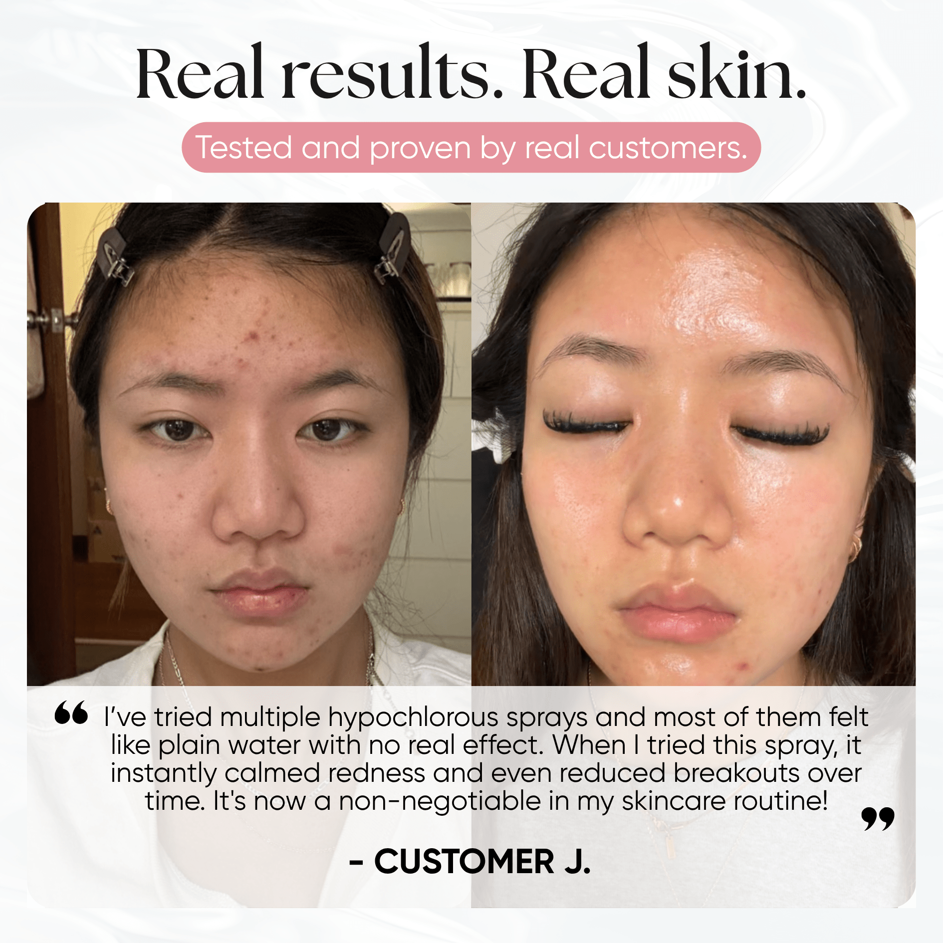 Skin Reset Hypochlorous Spray - CHEEKYGLO