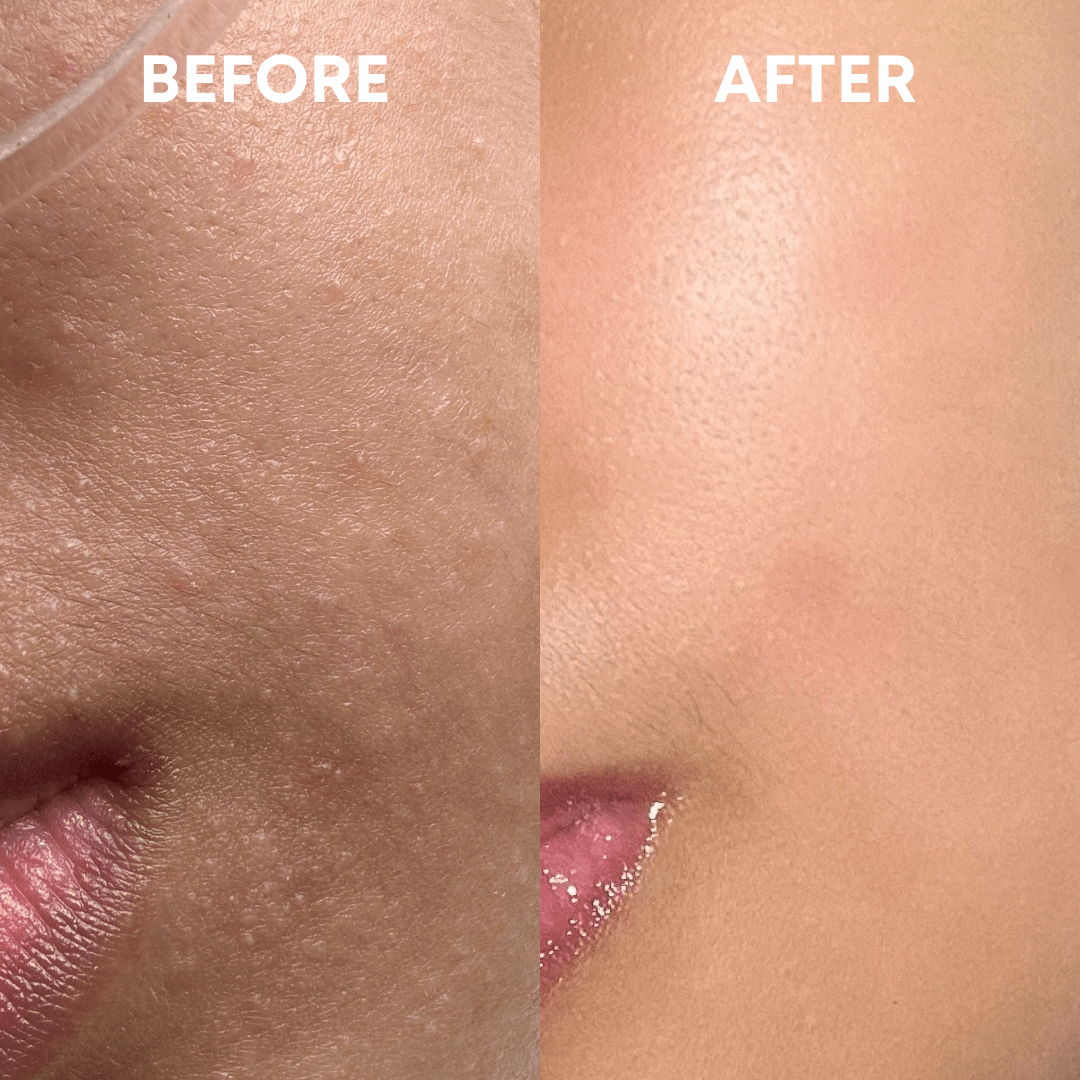 Skin Reset Hypochlorous Spray - CHEEKYGLO