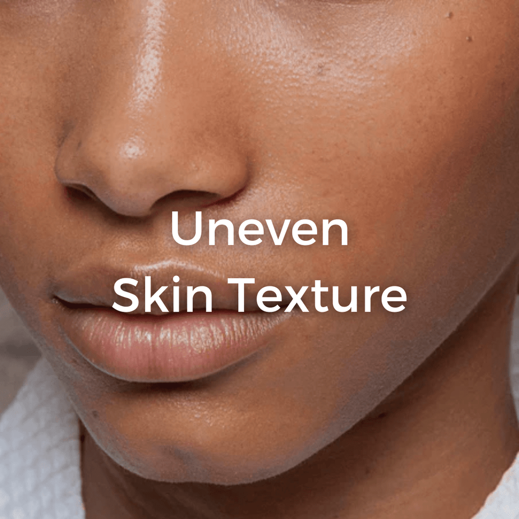 How To Treat Uneven Skin Texture - CHEEKYGLO