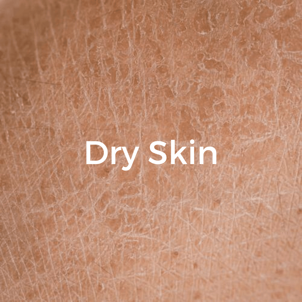 Need Help with Dry, Rough-looking skin? - CHEEKYGLO