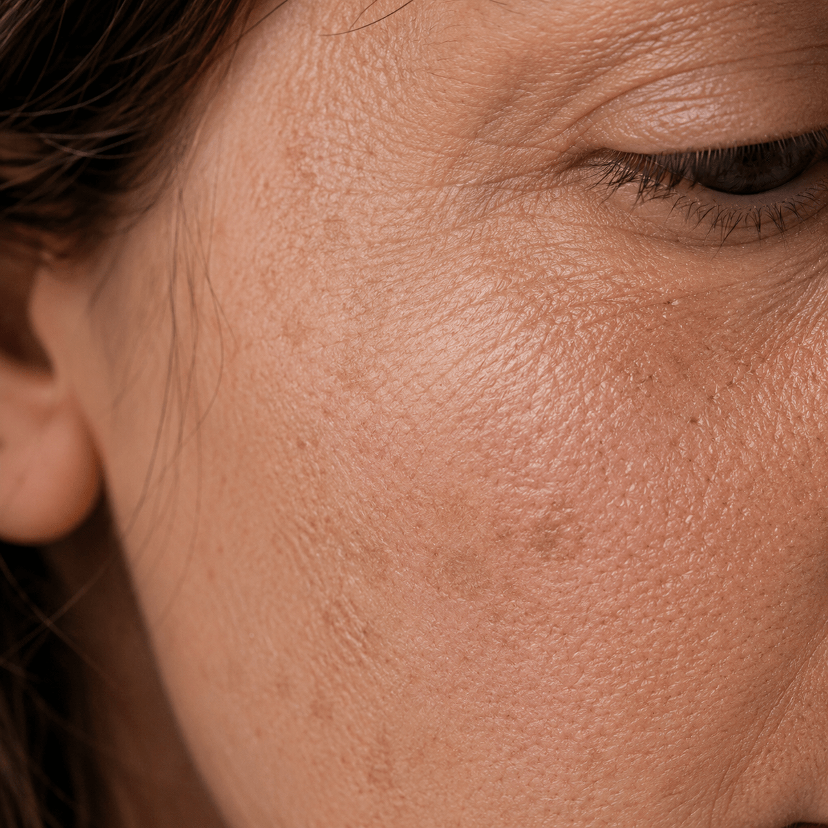 Ageing, Firmness & Collagen - CHEEKYGLO