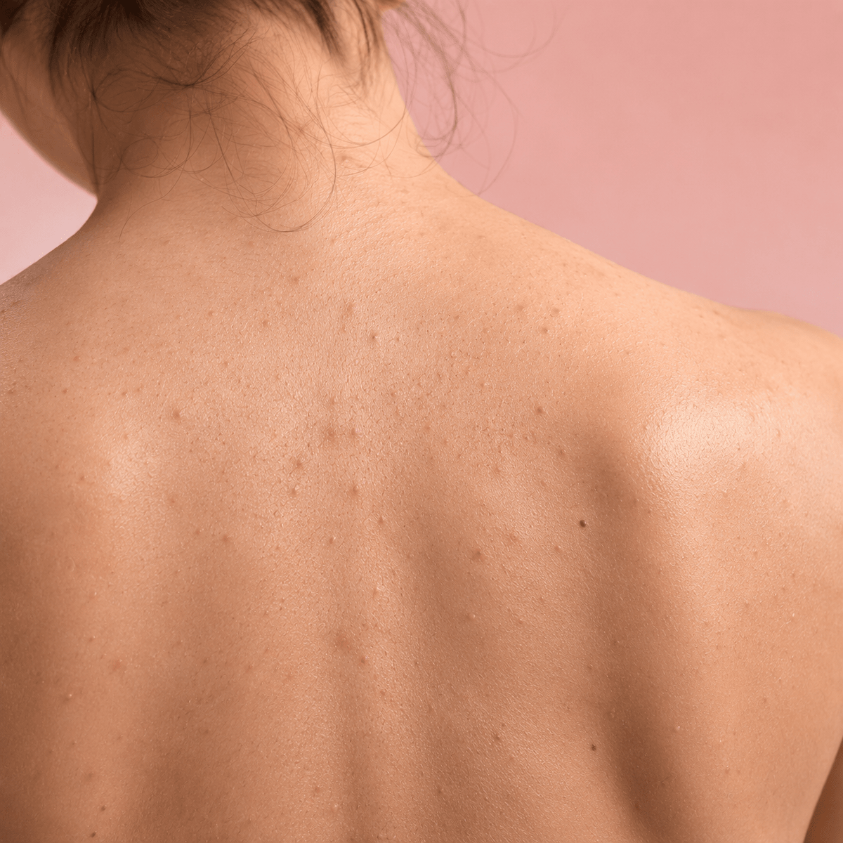 Breakouts & Congestion - CHEEKYGLO
