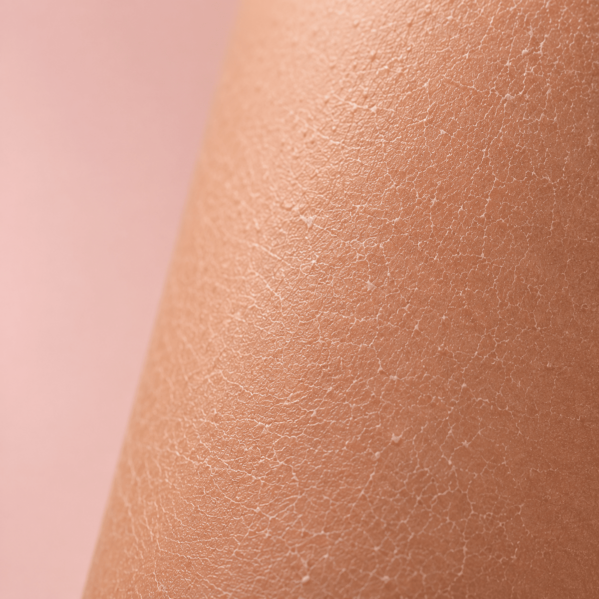 Rough, Dry & Dehydrated Skin - CHEEKYGLO