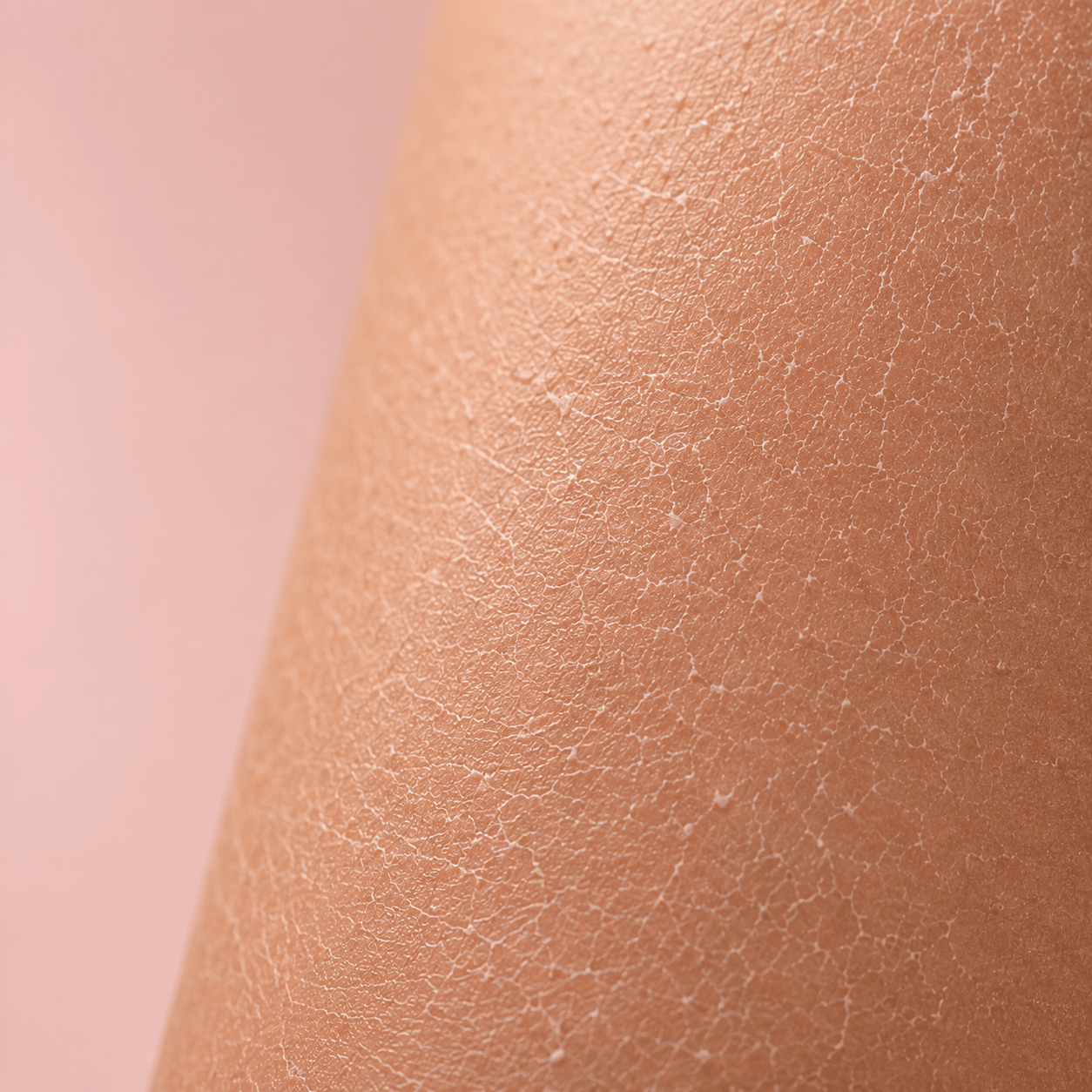 Rough, Dry &amp; Dehydrated Skin - CHEEKYGLO