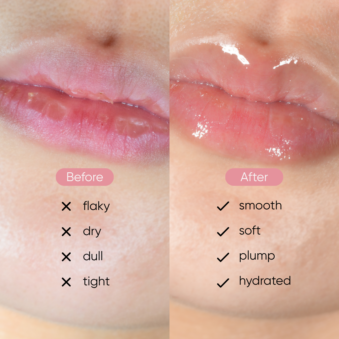 Peptide Lip Essence