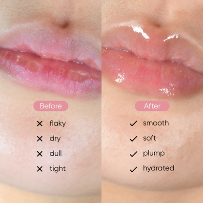 Peptide Lip Essence