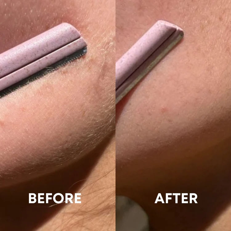 before and after result showing how cheekyglo dermablades effectively remove facial hair and peach fuzz