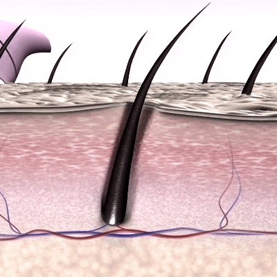 GIF showing the effect of using the CheekyGlo Dermablade on the face