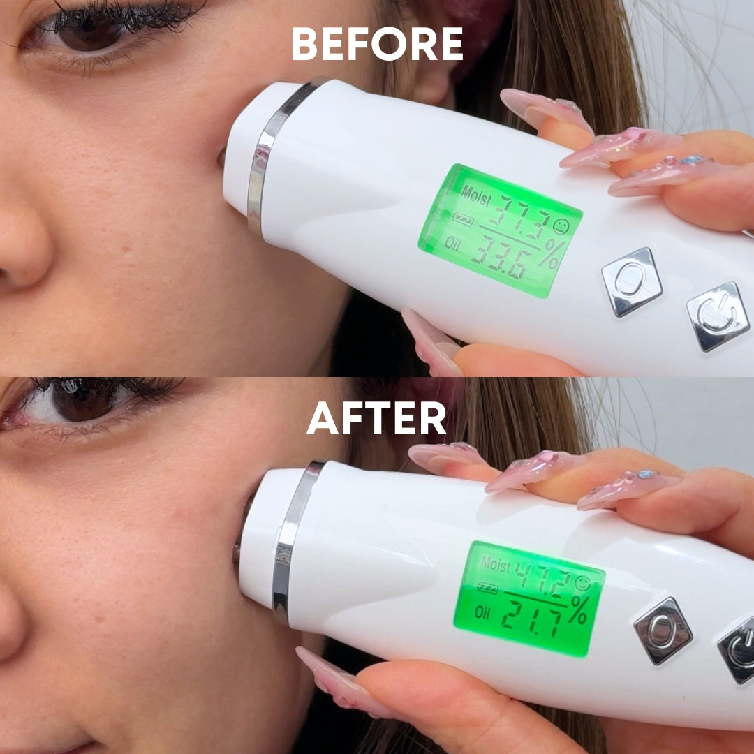 before and after hydration results of a woman after using the viral cheekyglo ice slushy sooting mask