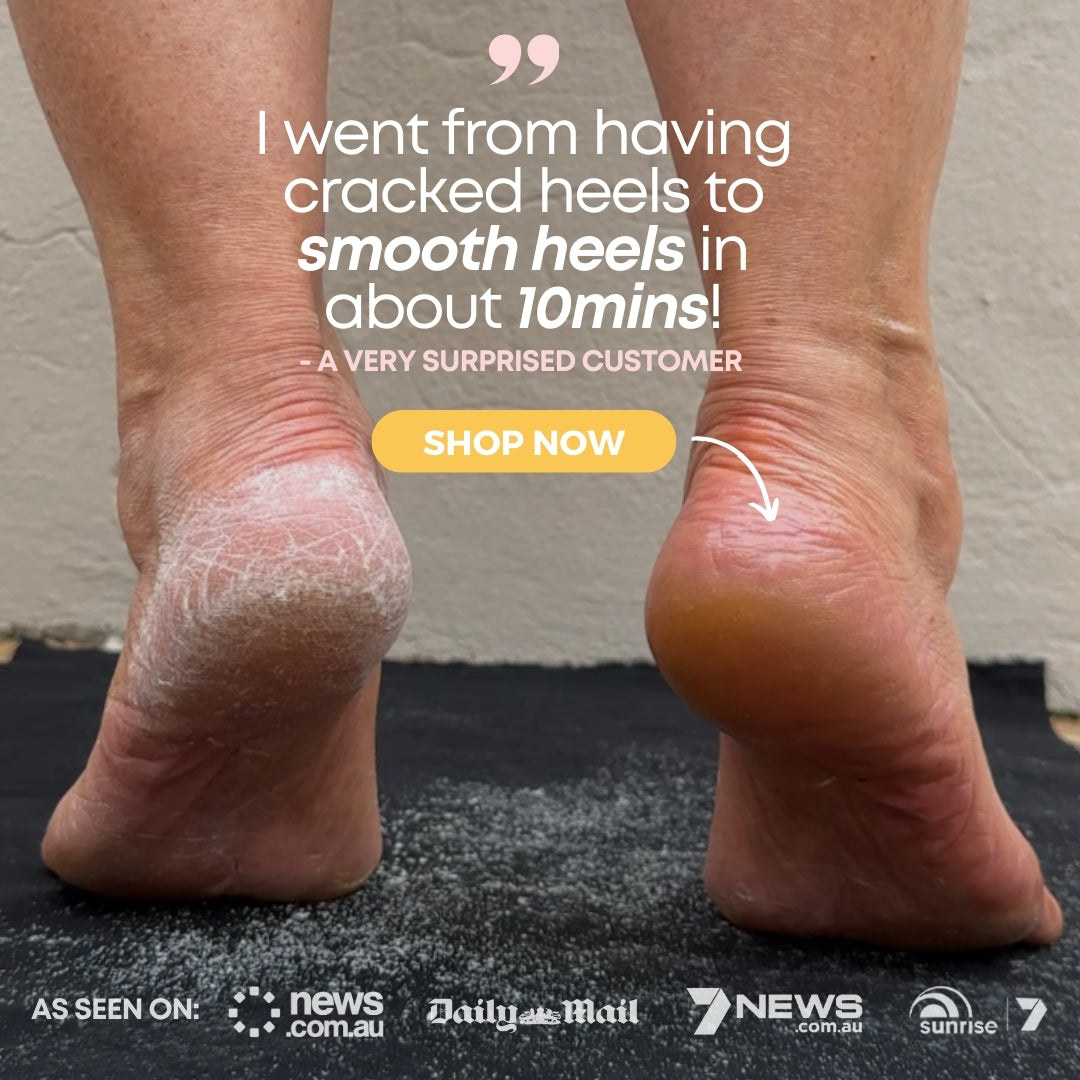 The image depicts a pair of feet, one with a cracked and dry heel and the other smooth and moisturized, showcasing a skincare transformation. Text reads, "I switched to using the CheekyGlo Scrub &amp; Buff Set and achieved smooth heels in just 10 minutes!" with logos of news outlets below.