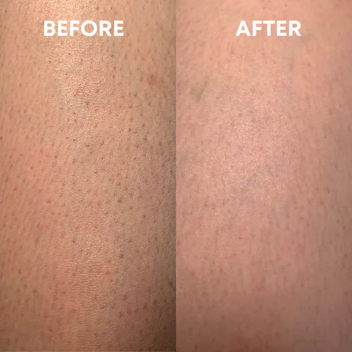 before and after using the cheekyglo exfoliating glove on kp strawberry skin