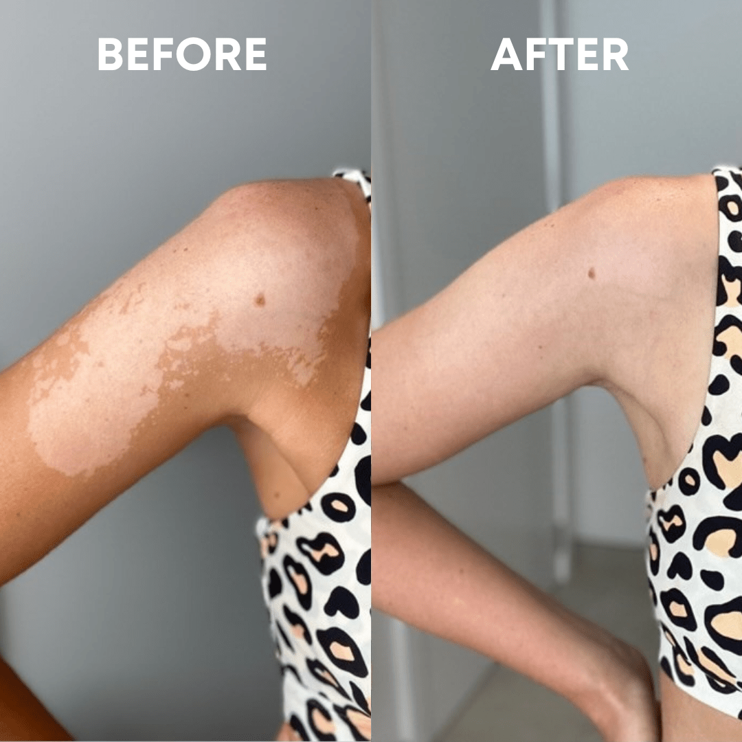 CheekyGlo Exfoliating Glove - CHEEKYGLO