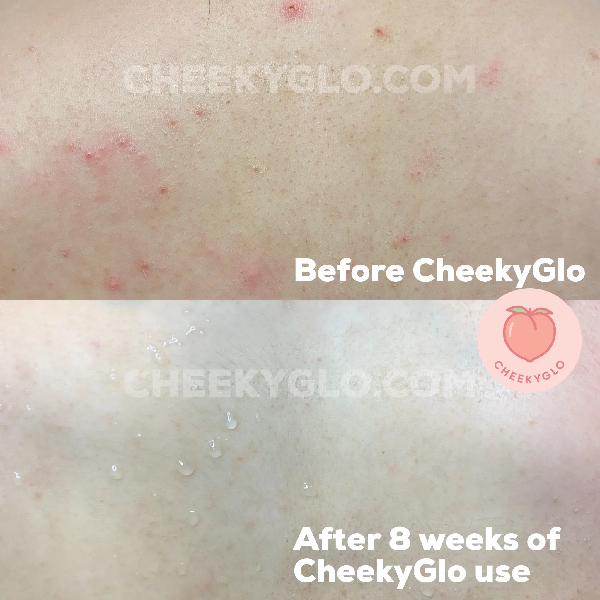 CheekyGlo Exfoliating Glove - CHEEKYGLO