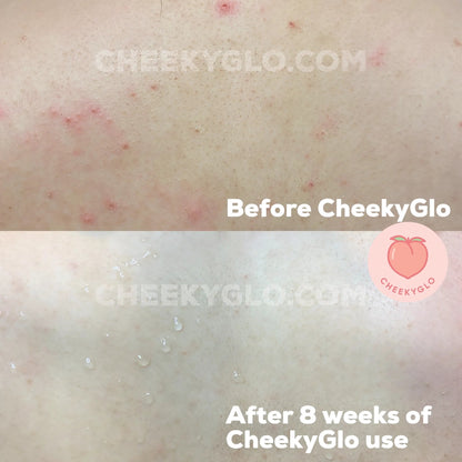 CheekyGlo Exfoliating Glove - CHEEKYGLO