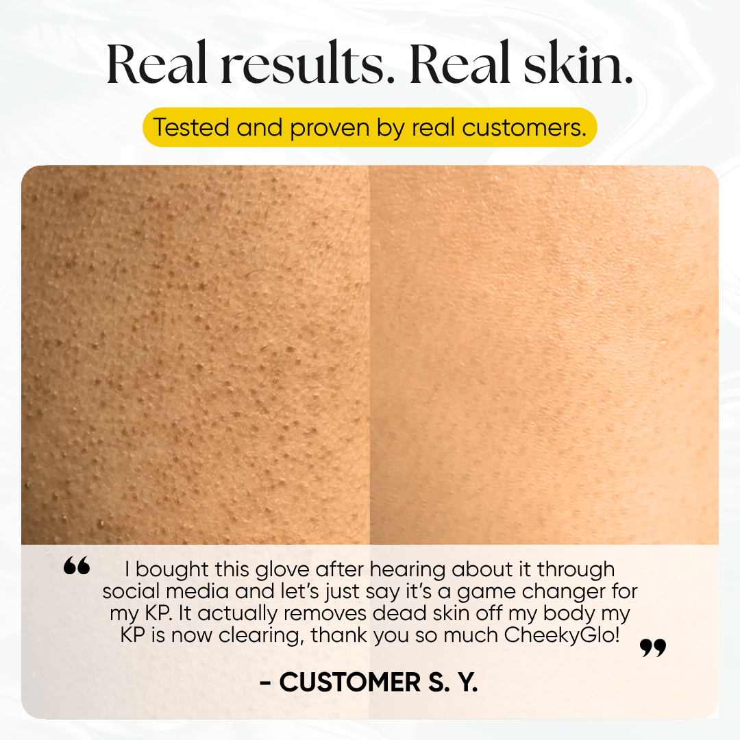 CheekyGlo Exfoliating Glove - CHEEKYGLO