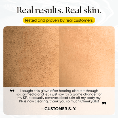 CheekyGlo Exfoliating Glove - CHEEKYGLO