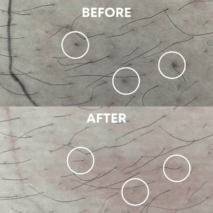 CheekyGlo Exfoliating Glove - CHEEKYGLO