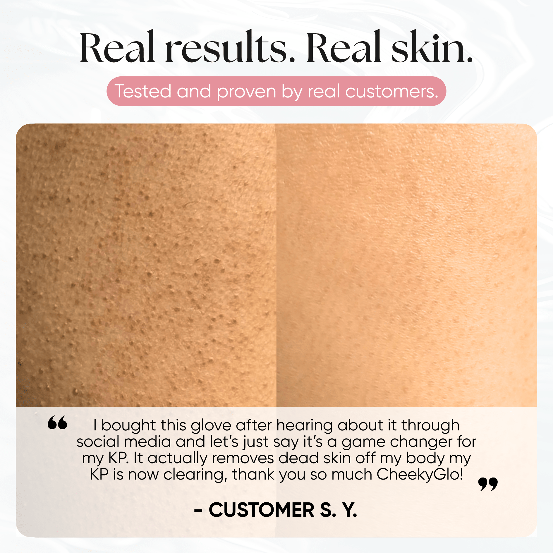 CheekyGlo Exfoliating Glove - CHEEKYGLO