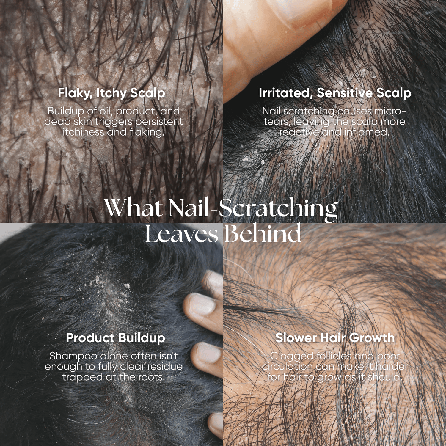 CheekyGlo Scalp Scrubber - CHEEKYGLO