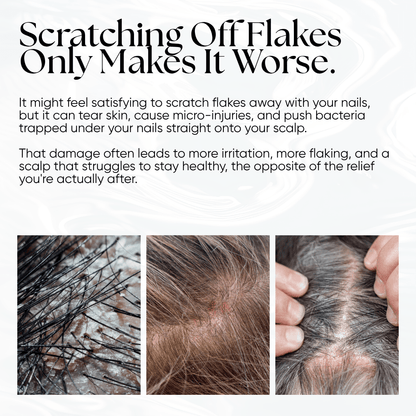 CheekyGlo Scalp Scrubber - CHEEKYGLO