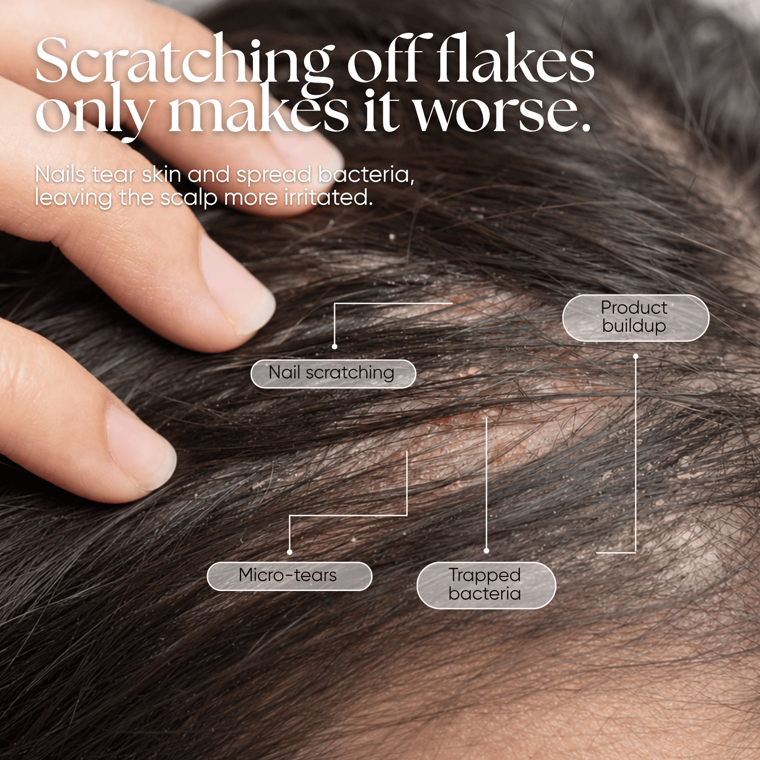 CheekyGlo Scalp Scrubber - CHEEKYGLO