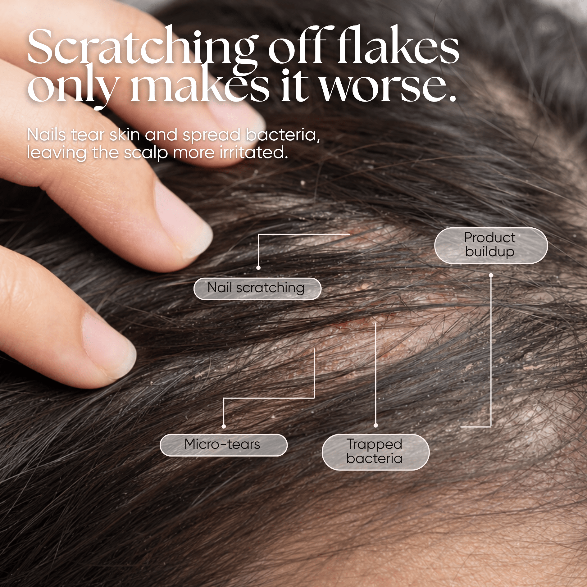 CheekyGlo Scalp Scrubber - CHEEKYGLO