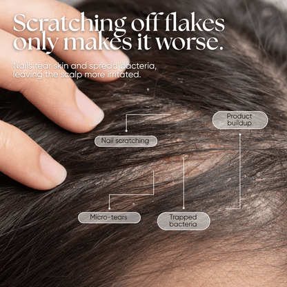 CheekyGlo Scalp Scrubber - CHEEKYGLO