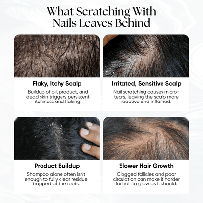 CheekyGlo Scalp Scrubber - CHEEKYGLO