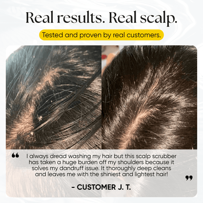 CheekyGlo Scalp Scrubber - CHEEKYGLO