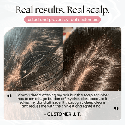 CheekyGlo Scalp Scrubber - CHEEKYGLO
