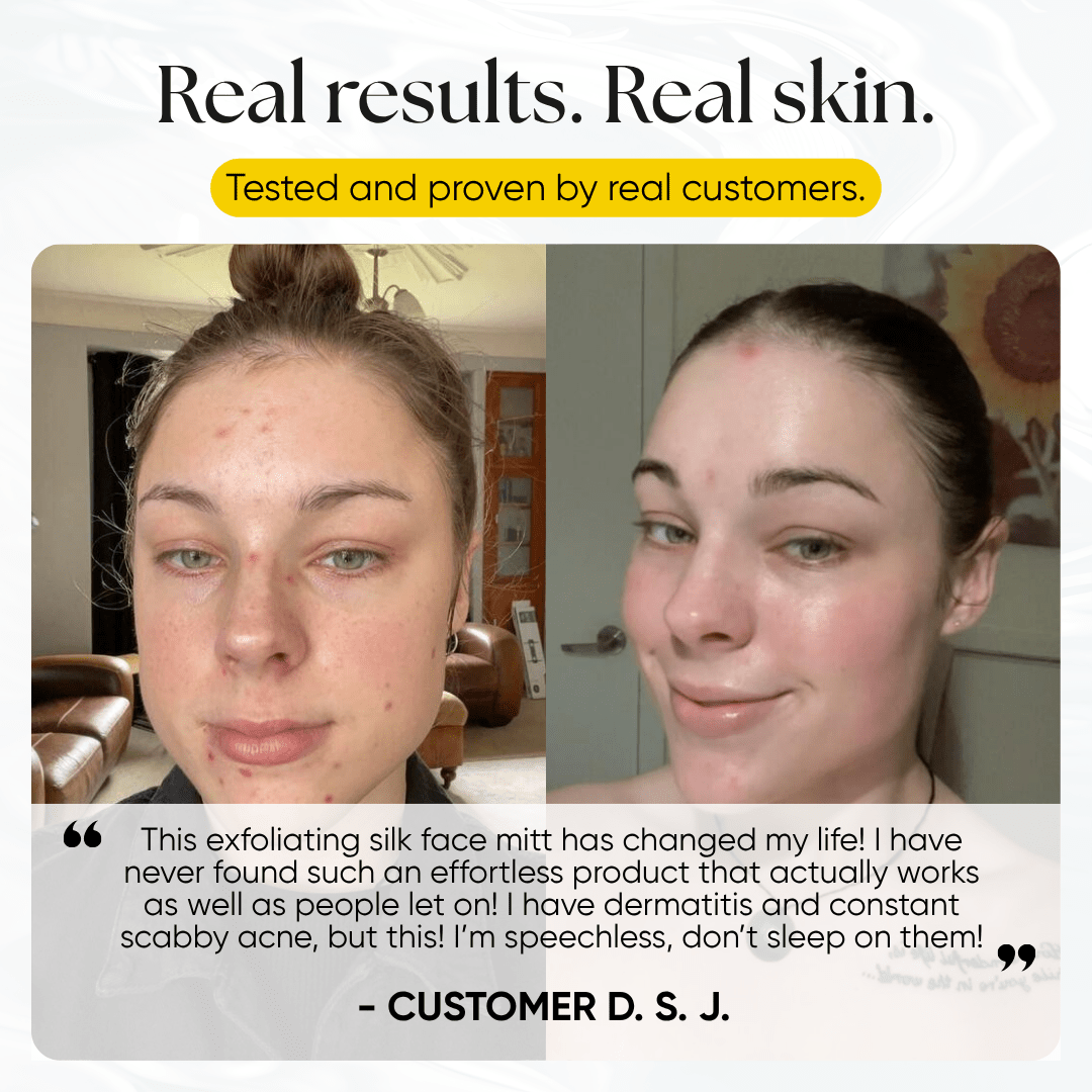 CheekyGlo Silk Exfoliating Face Mitt - CHEEKYGLO